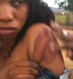 Pictures of the alleged assault of EX Beauty Queen